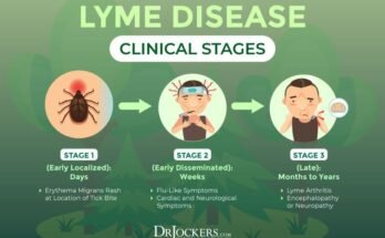 Lyme Disease