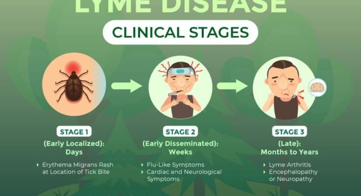 Lyme Disease